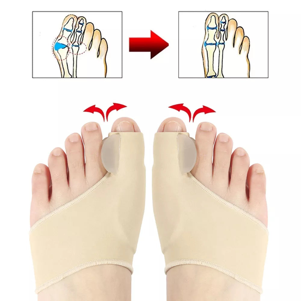 Restora Toe™ Orthopedic Daytime Bunion Sleeve