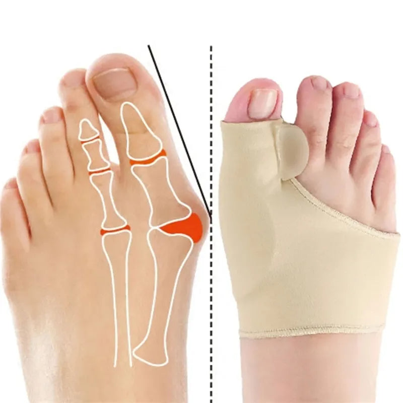 Restora Toe™ Orthopedic Daytime Bunion Sleeve