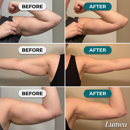 Luvantia - Lumea ® Lymphatic Drops
