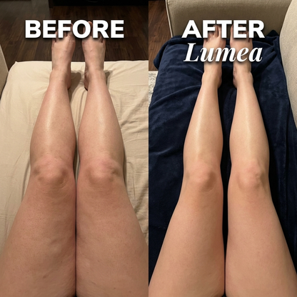 Luvantia - Lumea ® Lymphatic Drops