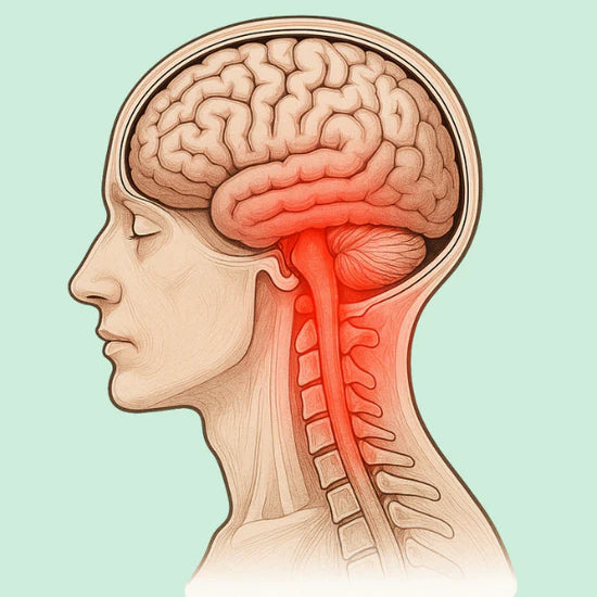 Cervicogenic Migraine