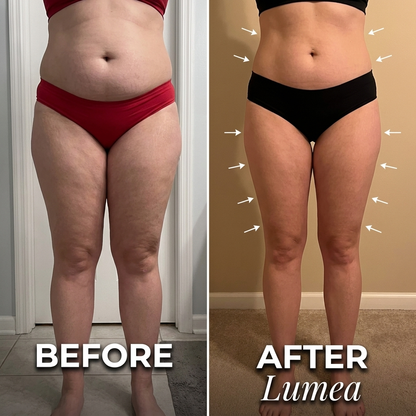 Luvantia - Lumea ® Lymphatic Drops