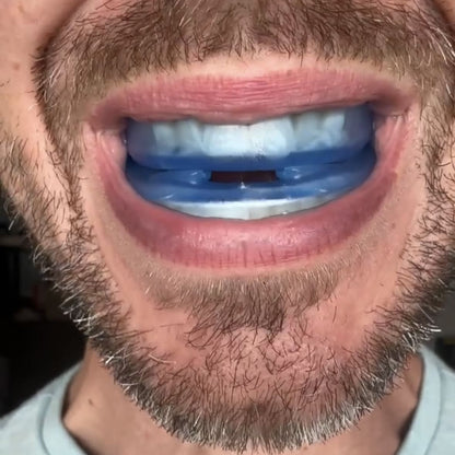 Stillnight™ — Anti-Snoring Mouthpiece Universal Size