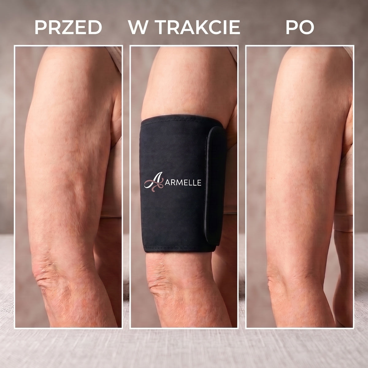 Armelle® Opaski na Ramiona
