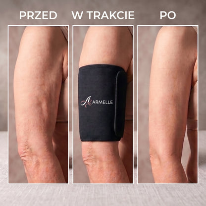 Armelle® Opaski na Ramiona